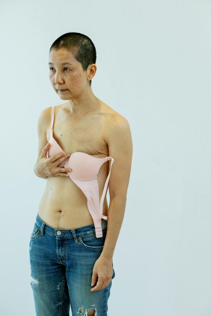 Symptoms of Breast Cancer: How to Stay Safe and Protect Yourself 4 a woman after breast cancer surgery